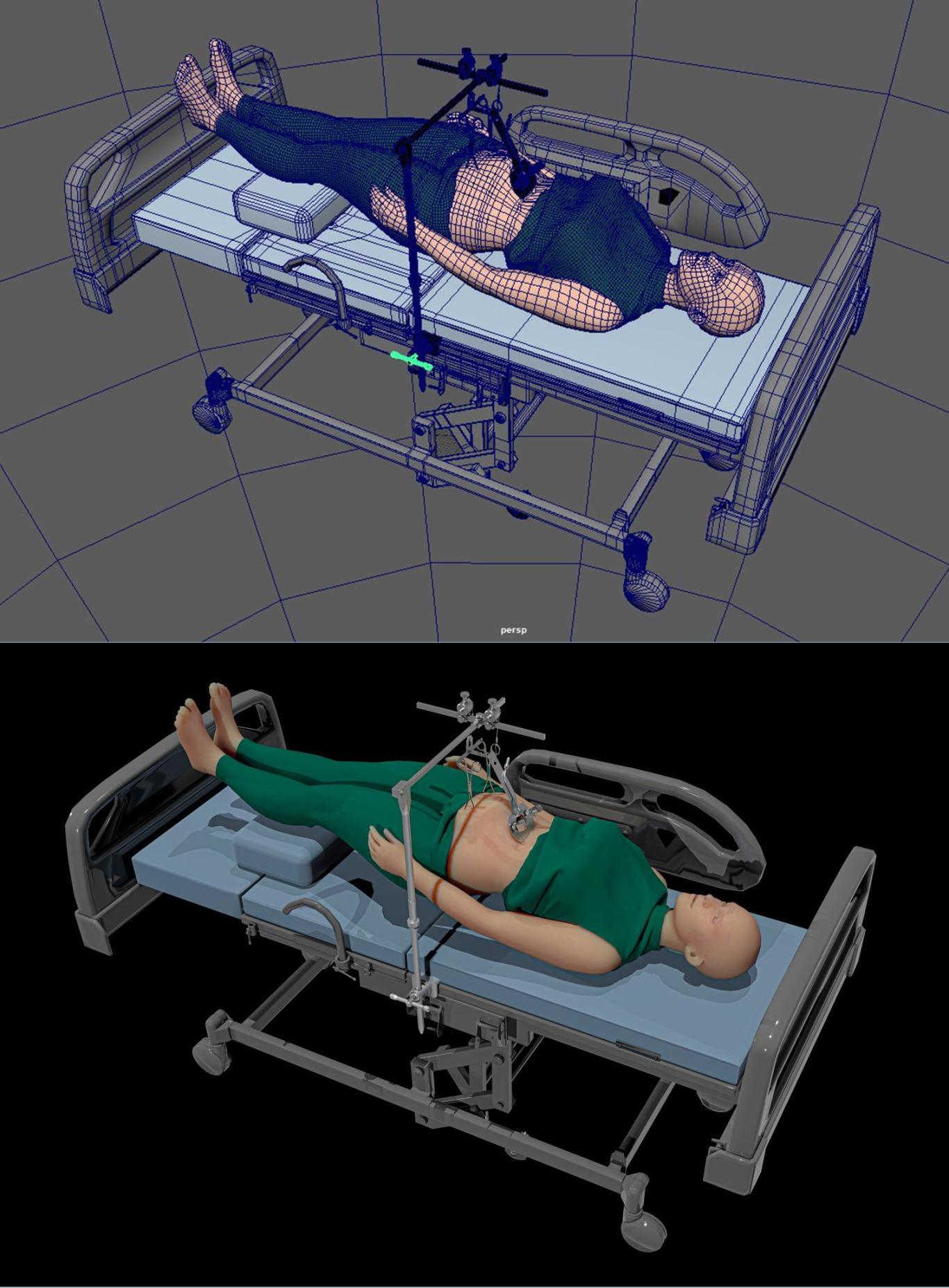 医疗器械展示动画图2