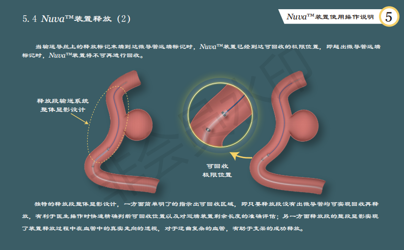 泰杰伟业公司动脉栓塞装置系统使用手册设计图12